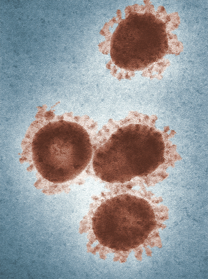 MD Confirms 2 cases of Coronavirus in MoCo